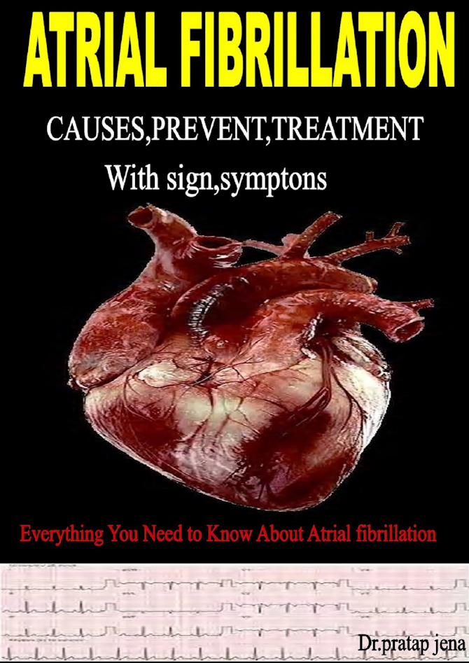 Atrial Fibrillation Signs,Symptoms,Causes, Prevent & Treatment - Payhip